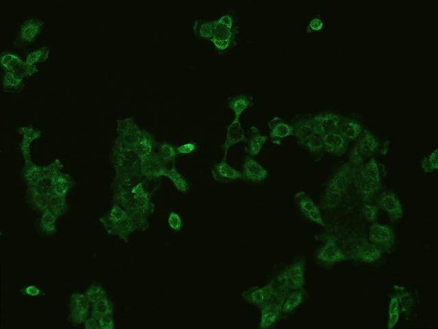 CXCL11 Antibody - Immunofluorescence staining of CXCL11 in A431 cells. Cells were fixed with 4% PFA, permeabilzed with 0.1% Triton X-100 in PBS, blocked with 10% serum, and incubated with mouse anti- CXCL11 monoclonal antibody (dilution ratio 1:60) at 4°C overnight. Then cells were stained with the Alexa Fluor 488-conjugated Goat Anti-mouse IgG secondary antibody (green). Positive staining was localized to Cytoplasm.