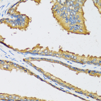 CXCL11 Antibody - Immunohistochemistry of paraffin-embedded human prostate.