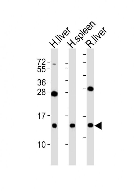 CXCL11 Antibody - All lanes : Anti-CXCL11 Antibody at 1:2000 dilution Lane 1: human liver lysates Lane 2: human spleen lysates Lane 3: rat liver lysates Lysates/proteins at 20 ug per lane. Secondary Goat Anti-Rabbit IgG, (H+L), Peroxidase conjugated at 1/10000 dilution Predicted band size : 10 kDa Blocking/Dilution buffer: 5% NFDM/TBST.