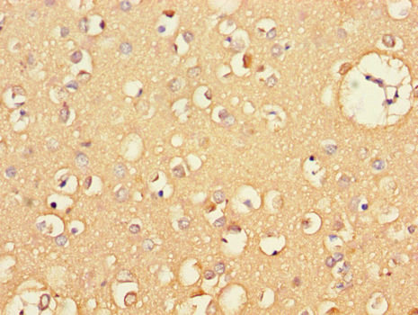 CXCL11 Antibody - Immunohistochemistry of paraffin-embedded human brain tissue using CXCL11 Antibody at dilution of 1:100