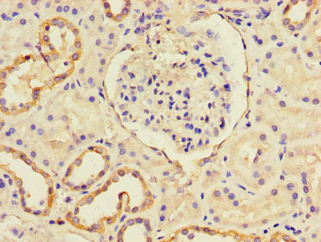 CXCL11 Antibody - Immunohistochemistry of paraffin-embedded human renal tissue using CXCL11 Antibody at dilution of 1:100