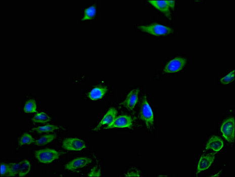 CXCL11 Antibody - Immunofluorescent analysis of Hela cells using CXCL11 Antibody at a dilution of 1:100 and Alexa Fluor 488-congugated AffiniPure Goat Anti-Rabbit IgG(H+L)