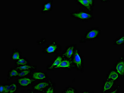 CXCL11 Antibody - Immunofluorescent analysis of Hela cells using CXCL11 Antibody at dilution of 1:100 and Alexa Fluor 488-congugated AffiniPure Goat Anti-Rabbit IgG(H+L)
