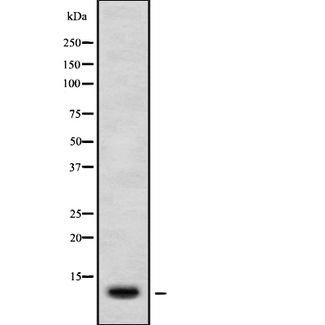 CXCL11 Antibody - Western blot analysis of CXCL11 using HuvEc whole cells lysates