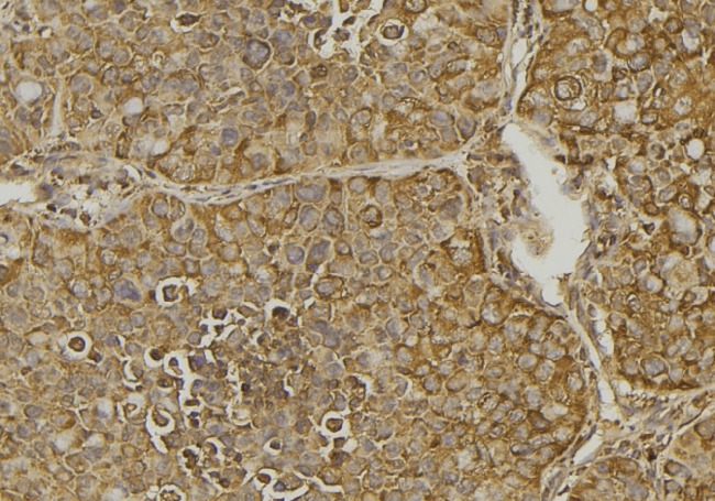 CXCL11 Antibody - 1:100 staining human pancreas tissue by IHC-P. The sample was formaldehyde fixed and a heat mediated antigen retrieval step in citrate buffer was performed. The sample was then blocked and incubated with the antibody for 1.5 hours at 22°C. An HRP conjugated goat anti-rabbit antibody was used as the secondary.