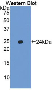 Cxcl15 Antibody - Western Blot; Sample: Recombinant protein.