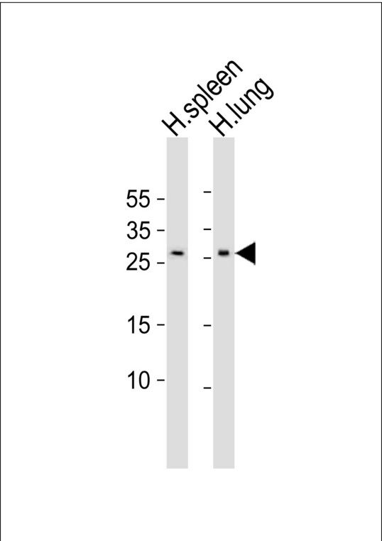 CXCL16 Antibody - Western blot of lysates from human spleen, human lung tissue lysate (from left to right) with CXCL16 Antibody. Antibody was diluted at 1:500 at each lane. A goat anti-rabbit IgG H&L (HRP) at 1:10000 dilution was used as the secondary antibody. Lysates at 20 ug per lane.