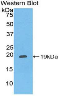CXCL16 Antibody - Western blot of recombinant CXCL16.  This image was taken for the unconjugated form of this product. Other forms have not been tested.