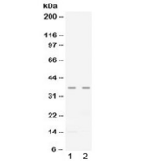 CXCL16 Antibody - Western blot testing of human 1) CEM and 2) A549 lysate with CXCL16 antibody at 0.5ug/ml. Predicted molecular weight ~29 kDa, glycosylated form ~60 kDa, cleaved glycosylated form ~35 kDa.