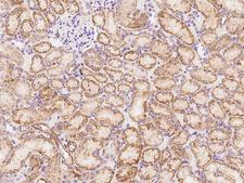 CXCL16 Antibody - Immunochemical staining of rat CXCL16 in rat kidney with rabbit polyclonal antibody at 1:1000 dilution, formalin-fixed paraffin embedded sections.