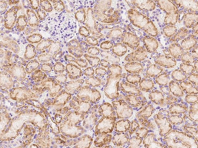 CXCL16 Antibody - Immunochemical staining of rat CXCL16 in rat kidney with rabbit polyclonal antibody at 1:1000 dilution, formalin-fixed paraffin embedded sections.