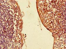 CXCL3 / GRO Gamma Antibody - Immunohistochemistry of paraffin-embedded human tonsil tissue using CXCL3 Antibody at dilution of 1:100