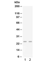 CXCL3 / GRO Gamma Antibody - Western blot testing of 1) mouse lung and 2) mouse spleen lysate with Gro gamma antibody. Predicted molecular weight ~11 kDa, observed here at ~25 kD