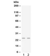 CXCL3 / GRO Gamma Antibody - Western blot testing of 1) mouse lung and 2) mouse spleen lysate with Gro gamma antibody. Predicted molecular weight ~11 kDa, observed here at ~25 kD