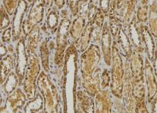 CXCL3 / GRO Gamma Antibody - 1:100 staining mouse kidney tissue by IHC-P. The sample was formaldehyde fixed and a heat mediated antigen retrieval step in citrate buffer was performed. The sample was then blocked and incubated with the antibody for 1.5 hours at 22°C. An HRP conjugated goat anti-rabbit antibody was used as the secondary.