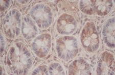 CXCL3 / GRO Gamma Antibody - Immunohistochemistry of paraffin-embedded Mouse intestines using CXCL3 Polyclonal Antibody at dilution of 1:50.