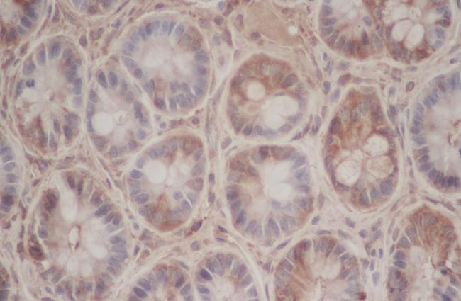 CXCL3 / GRO Gamma Antibody - Immunohistochemistry of paraffin-embedded Mouse intestines using CXCL3 Polyclonal Antibody at dilution of 1:50.