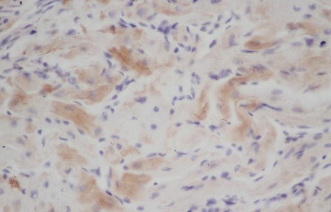 CXCL3 / GRO Gamma Antibody - Immunohistochemistry of paraffin-embedded Rat heart using CXCL3 Polyclonal Antibody at dilution of 1:50.