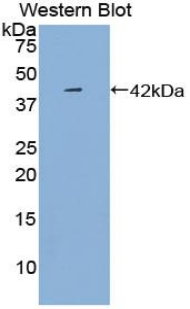 CXCL4 / PF4 Antibody - Western blot of recombinant CXCL4 / PF4.
