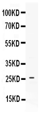 CXCL4 / PF4 Antibody - Western blot - Anti-PF4/Cxcl4 Picoband Antibody