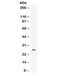 CXCL4 / PF4 Antibody - Western blot testing of mouse skeletal muslce lysate with PF4 antibody at 0.5ug/ml. Expected molecular weight: ~8/16/32 kDa (monomer/dimer/tetramer).