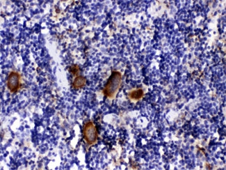 CXCL4 / PF4 Antibody - IHC testing of FFPE mouse spleen with PF4 antibody at 1ug/ml. HIER: steam in pH6 citrate buffer and allow to cool prior to staining.