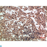 CXCL4 / PF4 Antibody - Immunohistochemical analysis of paraffin-embedded human-spleen, antibody was diluted at 1:200.