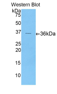 CXCL5 Antibody - Western blot of recombinant CXCL5.  This image was taken for the unconjugated form of this product. Other forms have not been tested.