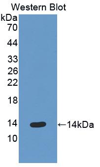 CXCL5 Antibody - Western blot of CXCL5 antibody.