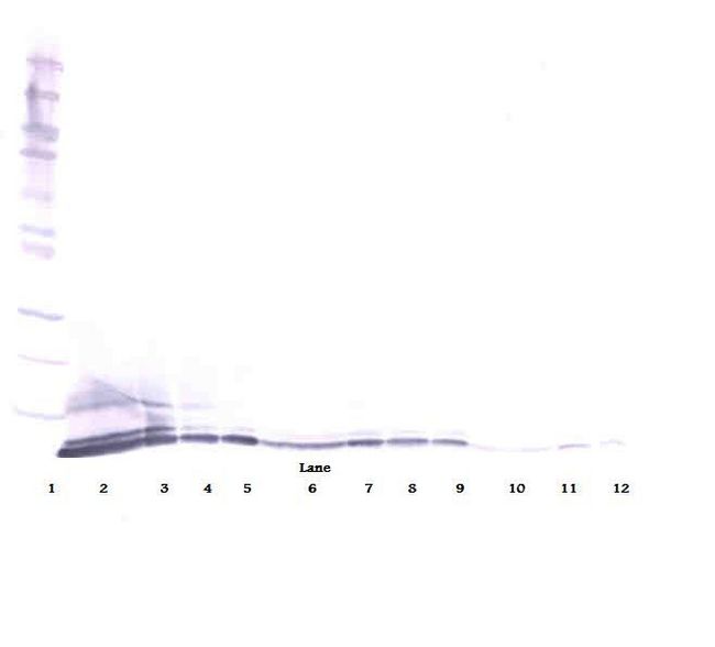 CXCL5 Antibody - Western Blot (reducing) of CXCL5 antibody. This image was taken for the unconjugated form of this product. Other forms have not been tested.