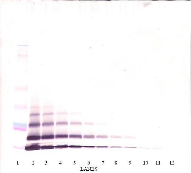 CXCL5 Antibody - Western Blot (non-reducing) of CXCL5 antibody. This image was taken for the unconjugated form of this product. Other forms have not been tested.