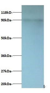 CXCL5 Antibody - Western blot of C-X-C motif chemokine 5 Antibody at 2 ug/ml + 293T whole cell lysate at 20 ug. Secondary: Goat polyclonal to Rabbit IgG at 1:15000 dilution. Predicted band size: 12.5 kDa. Observed band size: 90 kDa.  This image was taken for the unconjugated form of this product. Other forms have not been tested.