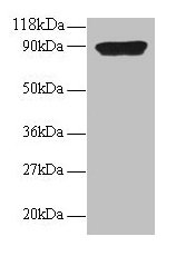CXCL5 Antibody - Western blot C-X-C motif chemokine 5 antibody at 2µg/ml + 293T whole cell lysate Secondary Goat polyclonal to rabbit IgG at 1/15000 dilution Predicted band size: 12.5 kDa Observed band size: 90 kDa
