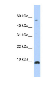 CXCL6 Antibody - CXCL6 antibody Western blot of Transfected 293T cell lysate. This image was taken for the unconjugated form of this product. Other forms have not been tested.