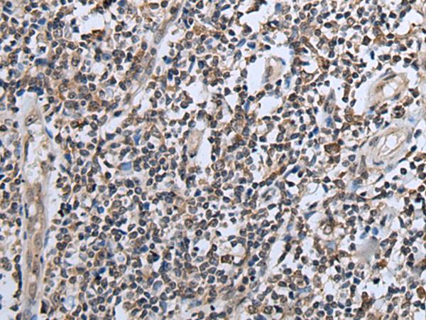 CXCL6 Antibody - Immunohistochemistry of paraffin-embedded Human tonsil tissue  using CXCL6 Polyclonal Antibody at dilution of 1:60(×200)