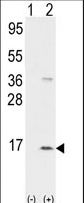 CXCL7 / PPBP Antibody - Western blot of PPBP (arrow) using rabbit polyclonal PPBP Antibody. 293 cell lysates (2 ug/lane) either nontransfected (Lane 1) or transiently transfected with the PPBP gene (Lane 2) (Origene Technologies). (8 ug/ml)