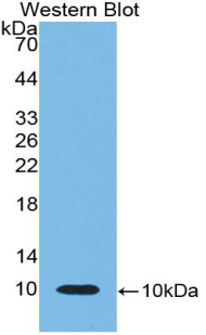 CXCL7 / PPBP Antibody - Western blot of CXCL7 / PPBP antibody.