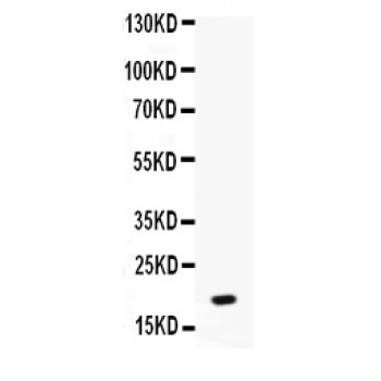 CXCL7 / PPBP Antibody - Western blot analysis of NAP2 expression in MCF-7 whole cell lysates (lane 1). NAP2 at 19 kD was detected using rabbit anti- NAP2 Antigen Affinity purified polyclonal antibody at 0.5 ug/mL. The blot was developed using chemiluminescence (ECL) method.