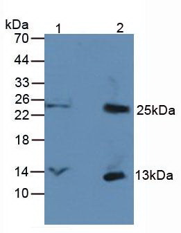 CXCL7 / PPBP Antibody - Western Blot Lane1: Rat Brain Tissue Lane2: Rat Liver Tissue Primary Ab: 3µg/mL Rabbit Anti-Human bTG Ab Second Ab: 1:5000 Dilution of HRP-Linked Rabbit Anti-Mouse IgG Ab