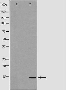 CXCL7 / PPBP Antibody - Western blot analysis of extracts of mouse liver tissue using PPBP antibody. The lane on the left is treated with the antigen-specific peptide.