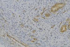 CXCL7 / PPBP Antibody - 1:100 staining human uterus tissue by IHC-P. The sample was formaldehyde fixed and a heat mediated antigen retrieval step in citrate buffer was performed. The sample was then blocked and incubated with the antibody for 1.5 hours at 22°C. An HRP conjugated goat anti-rabbit antibody was used as the secondary.