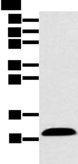 CXCL7 / PPBP Antibody - Western blot analysis of Human plasma solution  using PPBP Polyclonal Antibody at dilution of 1:500
