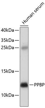 CXCL7 / PPBP Antibody - Western blot analysis of extracts of human serum using PPBP Polyclonal Antibody at dilution of 1:1000.
