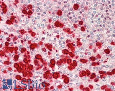 CXCL9 / MIG Antibody - Human Spleen: Formalin-Fixed, Paraffin-Embedded (FFPE).  This image was taken for the unconjugated form of this product. Other forms have not been tested.