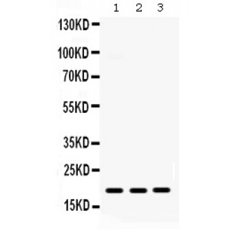 CXCL9 / MIG Antibody - MIG antibody Western blot. All lanes: Anti MIG at 0.5 ug/ml. Lane 1: Human Placenta Tissue Lysate at 50 ug. Lane 2: A431 Whole Cell Lysate at 40 ug. Lane 3: HELA Whole Cell Lysate at 40 ug. Predicted band size: 19 kD. Observed band size: 19 kD.