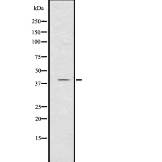 CXCR1 Antibody - Western blot analysis of CXCR1 using K562 whole lysates.