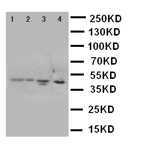 CXCR1 Antibody - WB of CXCR1 antibody. Lane 1: HELA Cell Lysate. Lane 2: COLO320 Cell Lysate. Lane 3: M231 Cell Lysate. Lane 4: HT1080 Cell Lysate.