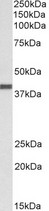 CXCR1 Antibody - Goat anti-CXCR1 (aa26-38) Antibody (0.3µg/ml) staining of Human Breast cancer lysate (35µg protein in RIPA buffer). Primary incubation was 1 hour. Detected by chemiluminescencence.