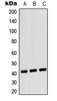 CXCR1 Antibody - Western blot analysis of CD181 expression in HEK293T (A); NIH3T3 (B); H9C2 (C) whole cell lysates.