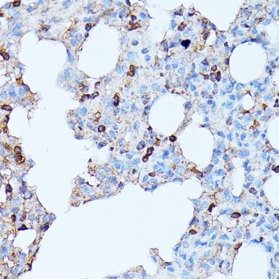 CXCR1 Antibody - Immunohistochemistry of paraffin-embedded Rat lung using CXCR1 Polyclonal Antibody at dilution of 1:100 (40x lens).